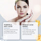 Acne Soothing Hydrating Facial Serum
