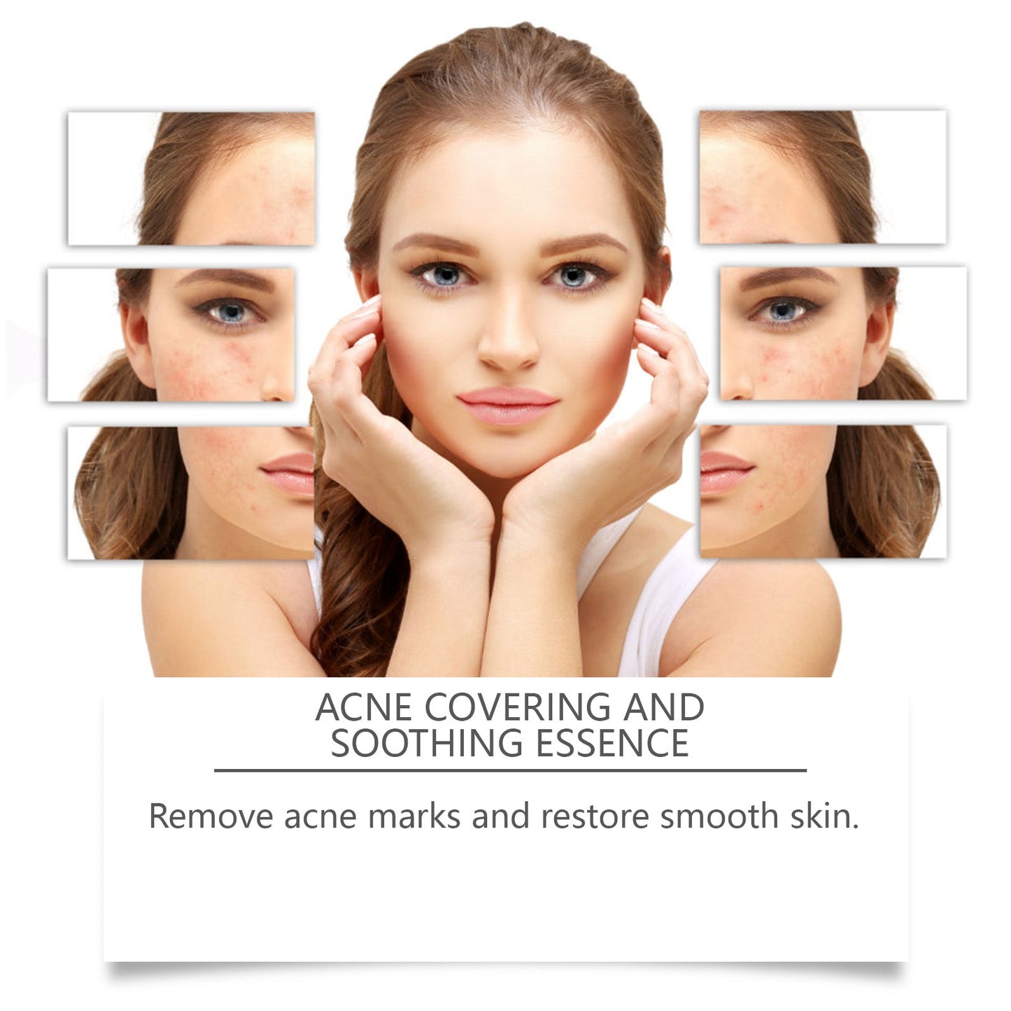 Acne Soothing Hydrating Facial Serum